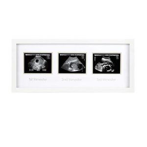 Trimester Progression Sonogram Picture Frame, Milestone Keepsake  Photo Frame